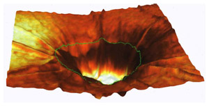 Diagnostischesspektrum in HRT 3